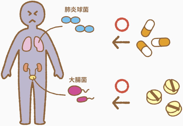 抗菌薬を内服する量や期間は、感染症の場所と原因菌の組み合わせで変わります